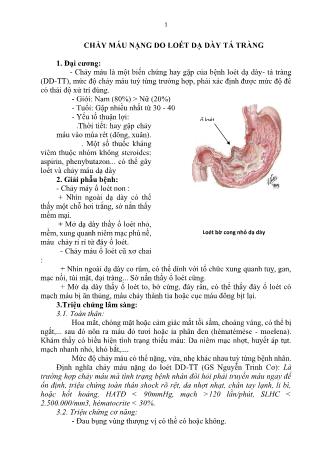 Tài liệu ôn thi vị trí bác sĩ Đa khoa - Ngoại khoa - Chảy máu nặng do loét dạ dày tá tràng