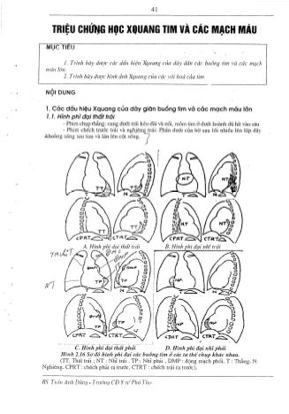 Tài liệu ôn thi vị trí Hình ảnh y học Cao đẳng - Chẩn đoán hình ảnh X-quang - Triệu chứng học X-quang tim và các mạch máu