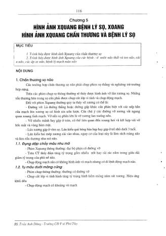 Tài liệu ôn thi vị trí Hình ảnh y học Cao đẳng - Chẩn đoán hình ảnh X-quang - Hình ảnh X-quang bệnh của bệnh lý sọ, xoang, hình ảnh xoang chấn thương và bệnh lý sọ