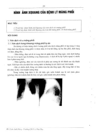 Tài liệu ôn thi vị trí Hình ảnh y học Cao đẳng - Chẩn đoán hình ảnh X-quang - Hình ảnh X-quang của bệnh lý màng phổi